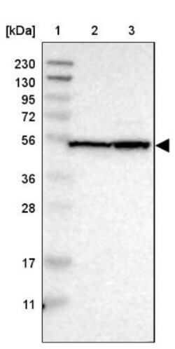 NLE1 Antibody, Novus Biologicals 0.1mL; Unlabeled:Antibodies, Polyclonal
