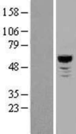 Novus Biologicals&trade;&nbsp;NLK Overexpression Lysate