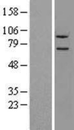 Novus Biologicals&trade;&nbsp;Neurolysin Overexpression Lysate