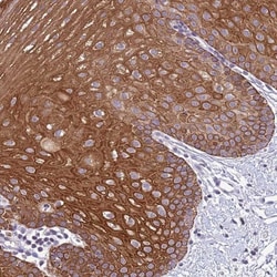 NLRP11 Antibody, Novus Biologicals 0.1mL; Unlabeled:Antibodies, Polyclonal