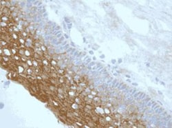 NLRP3/NALP3 Antibody (Nalpy3-b) - BSA Free, Novus Biologicals:Antibodies:Primary