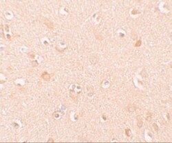 NLRP5 Antibody - BSA Free, Novus Biologicals 0.025 mg, Unconjugated:Antibodies,