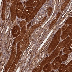 NLRP7 Antibody, Novus Biologicals 25 &mu;L, Unlabeled:Antibodies, Polyclonal