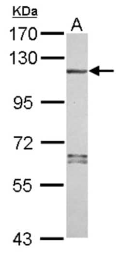 NLRP7 Antibody, Novus Biologicals 0.1mL; Unlabeled:Antibodies, Polyclonal