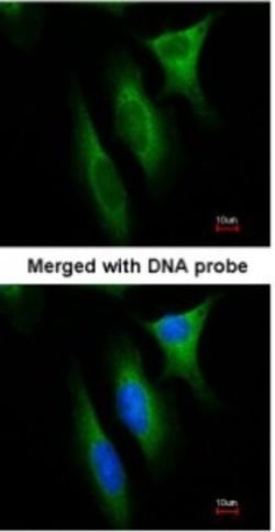 NM23-H1 Antibody, Novus Biologicals 0.1mL; Unlabeled:Antibodies, Polyclonal