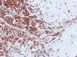 NM23-H1 Antibody, Novus Biologicals 0.1mL; Unlabeled:Antibodies, Polyclonal