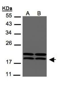 NM23-H1 Antibody, Novus Biologicals 0.1mL; Unlabeled:Antibodies, Polyclonal