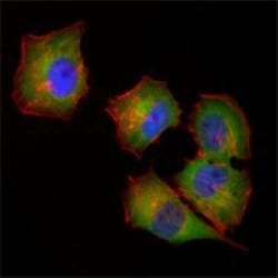 NM23-H1 Antibody (4B2), Novus Biologicals 0.1mL; Unlabeled:Antibodies,