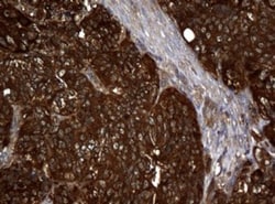 NM23-H1 Antibody (OTI4H2), Novus Biologicals 0.1mL; Unlabeled:Antibodies,