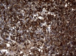 NM23-H1 Antibody (OTI4H2), Novus Biologicals 0.1mL; Unlabeled:Antibodies,
