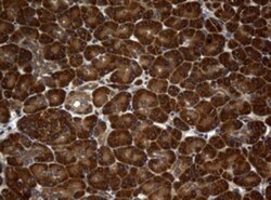 NM23-H1 Antibody (OTI4H2), Novus Biologicals 0.1mL; Unlabeled:Antibodies,