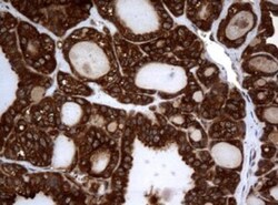 NM23-H1 Antibody (OTI4H2), Novus Biologicals 0.1mL; Unlabeled:Antibodies,