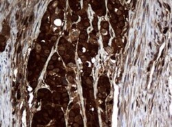 NM23-H1 Antibody (OTI4H2), Novus Biologicals 0.1mL; Unlabeled:Antibodies,