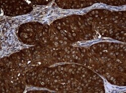 NM23-H1 Antibody (OTI4H2), Novus Biologicals 0.1mL; Unlabeled:Antibodies,