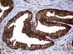 NM23-H1 Antibody (OTI4H2), Novus Biologicals 0.1mL; Unlabeled:Antibodies,
