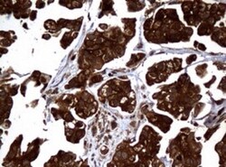 NM23-H1 Antibody (OTI4H2), Novus Biologicals 0.1mL; Unlabeled:Antibodies,
