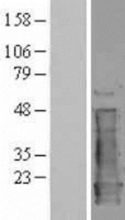 Novus Biologicals&trade;&nbsp;NM23-H1 Overexpression Lysate