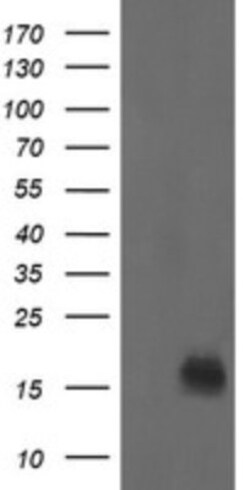 NM23-H2/NME2 Antibody (OTI2F9), Novus Biologicals 0.1mL; Unlabeled:Antibodies,