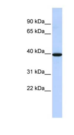 Neuromedin BR/NMBR Antibody, Novus Biologicals 20&mu;L; Unlabeled:Antibodies,