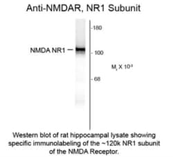 NMDAR1 Antibody (R1JHL), Novus Biologicals 0.015 mg | Buy Online | Novus Biologicals | Fisher Scientific