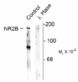 NMDAR2B, p Ser1480 Antibody, Novus Biologicals 0.1mL; Unlabeled:Antibodies,