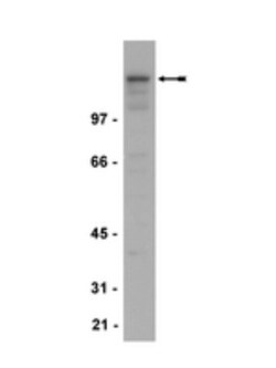 NMDAR2B Antibody (BWJHL), Novus Biologicals 0.1 mg; Unconjugated:Antibodies,