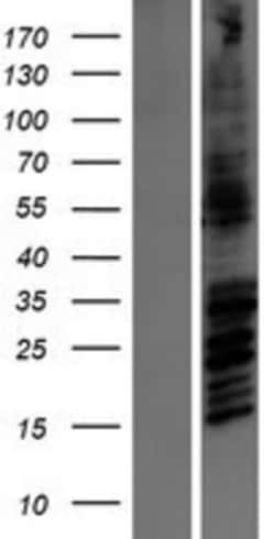 Novus Biologicals&trade;&nbsp;NMDAR2B Overexpression Lysate