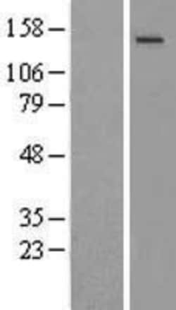 Novus Biologicals&trade;&nbsp;NMDAR2C Overexpression Lysate