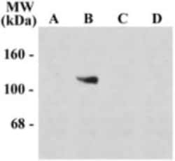 NMDA R, NR1 Subunit Antibody - Splice Variant, Novus Biologicals 0.025mg;