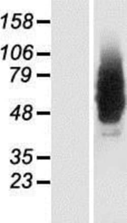 Novus Biologicals&trade;&nbsp;NMDARA1 Overexpression Lysate