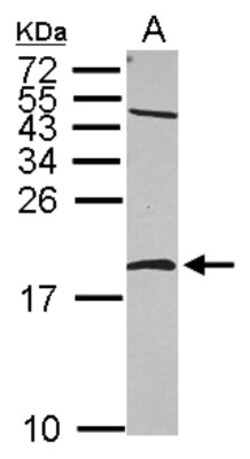 NM23-H2/NME2 Antibody, Novus Biologicals 0.1mL; Unlabeled:Antibodies, Polyclonal