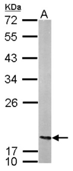 NM23-H2/NME2 Antibody, Novus Biologicals 0.1mL; Unlabeled:Antibodies, Polyclonal