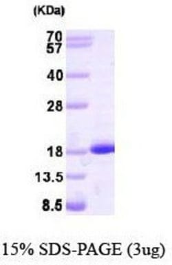 Novus Biologicals Recombinant Human NM23-H2/NME2 Protein 0.1 mg | Buy Online | Novus Biologicals&trade; | Fisher Scientific