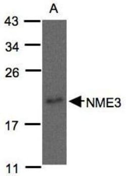NME3 Antibody, Novus Biologicals 0.1mg; Unlabeled:Antibodies, Polyclonal