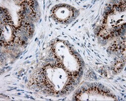 NME4 Antibody (OTI1A5), Novus Biologicals 0.1mL; Unlabeled:Antibodies,