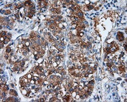 NME4 Antibody (OTI1A5), Novus Biologicals 0.1mL; Unlabeled:Antibodies,