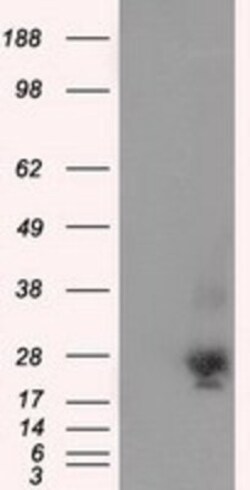 NME4 Antibody (OTI1A5), Novus Biologicals 0.1mL; Unlabeled:Antibodies,