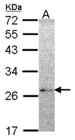 NME5 Antibody, Novus Biologicals 0.1mL; Unlabeled:Antibodies, Polyclonal