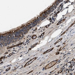 NME6 Antibody, Novus Biologicals:Antibodies:Primary Antibodies