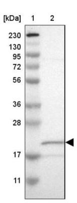 NME6 Antibody, Novus Biologicals:Antibodies:Primary Antibodies