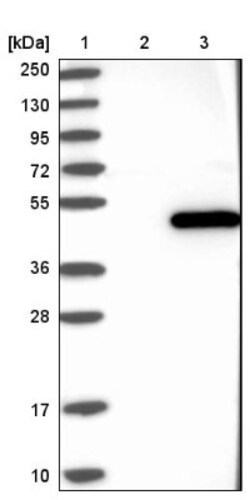NME7 Antibody, Novus Biologicals 0.1mL; Unlabeled:Antibodies, Polyclonal