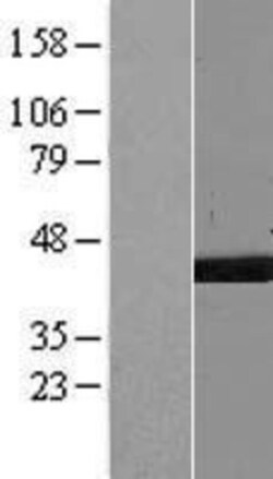 Novus Biologicals&trade;&nbsp;NME7 Overexpression Lysate