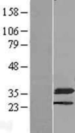 Novus Biologicals&trade;&nbsp;NMRAL1 Overexpression Lysate