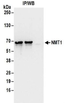 NMT1 Antibody, Novus Biologicals 0.1mg; Unlabeled:Antibodies, Polyclonal