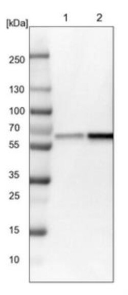 NMT1 Antibody, Novus Biologicals:Antibodies:Primary Antibodies