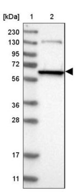 NMT1 Antibody, Novus Biologicals:Antibodies:Primary Antibodies