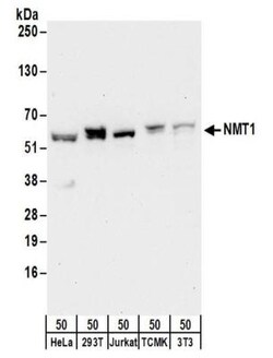 NMT1 Antibody, Novus Biologicals 0.1mg; Unlabeled:Antibodies, Polyclonal