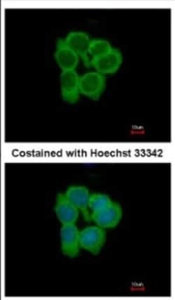 NMT2 Antibody, Novus Biologicals 0.1mL; Unlabeled:Antibodies, Polyclonal