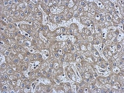 NMT2 Antibody, Novus Biologicals 0.1mL; Unlabeled:Antibodies, Polyclonal