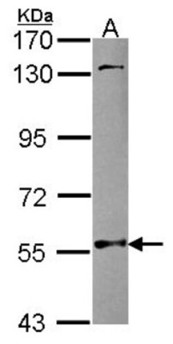 NMT2 Antibody, Novus Biologicals 0.1mL; Unlabeled:Antibodies, Polyclonal
